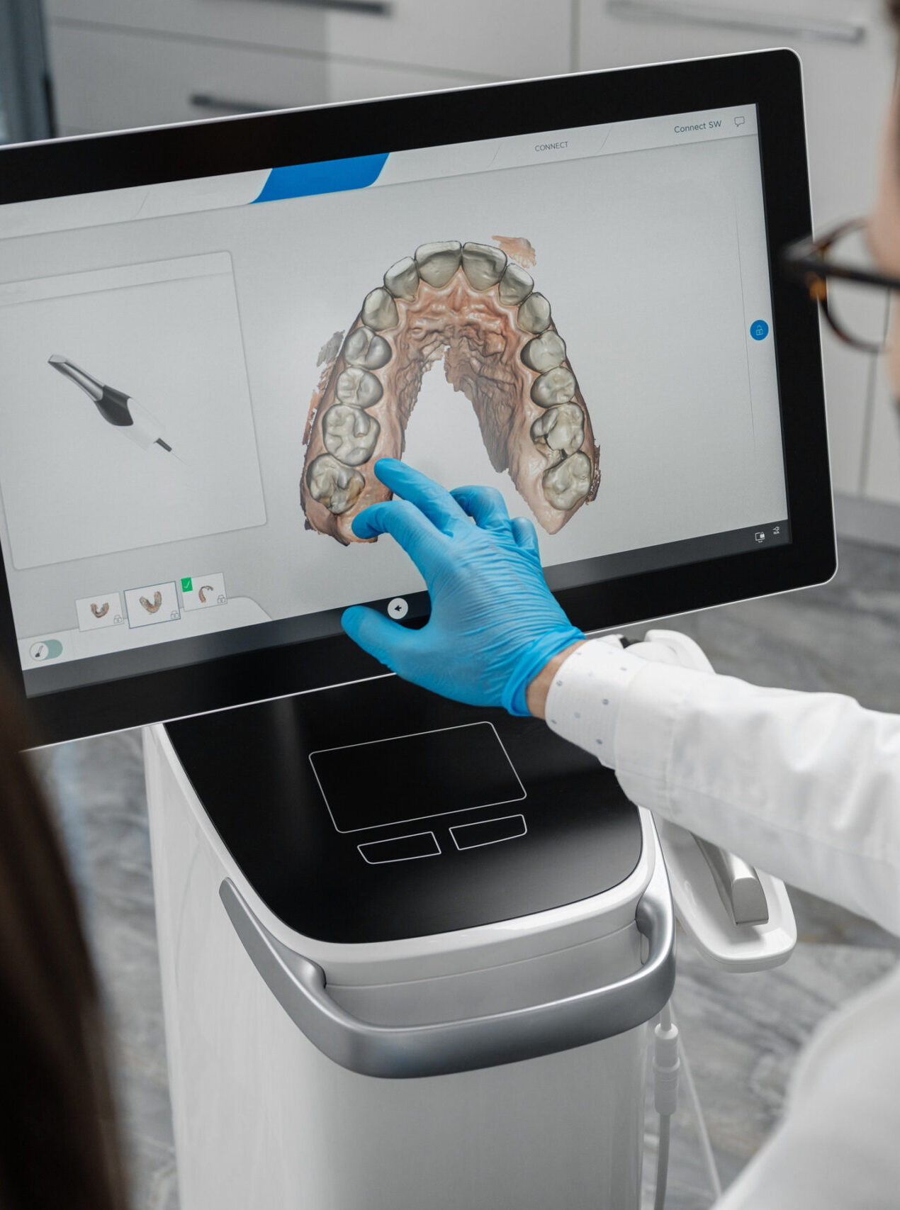 Male doctor show results of digital intraoral scan of patient teeth in 3D on display. Dentist point finger on screen