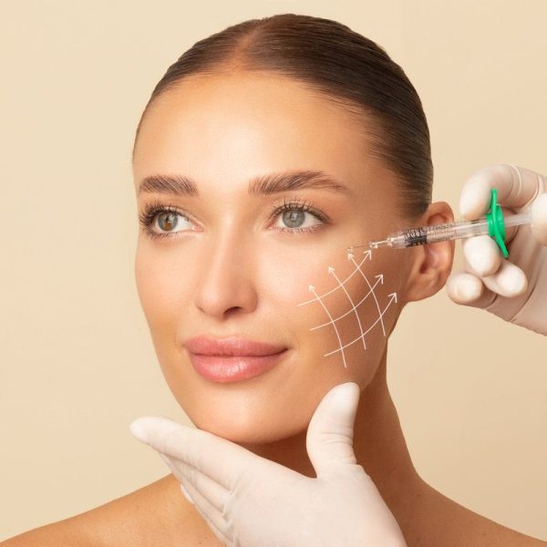 Beauty injections. Lifting lines on young woman's face showing skin tightening and face contour correction with beauty injections